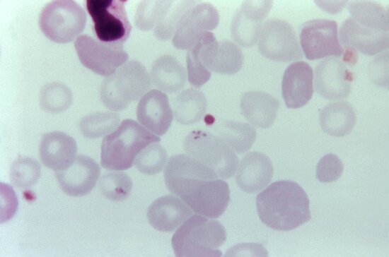 hemo, protozoan, parasites, genus, babesia