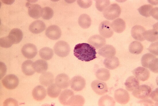 blood smear, photomicrograph, plasmodium vivax, macrogametocyte, mag, 1250x