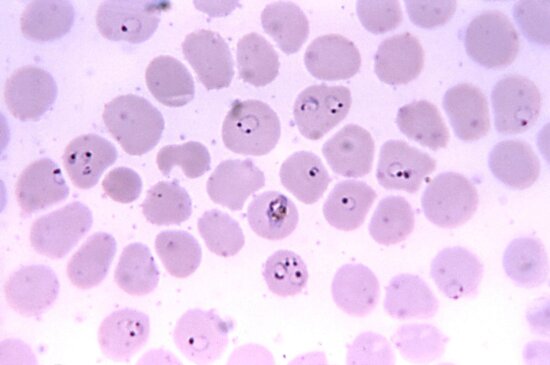 micrograph falciparum, rings, growing, trophozoite, mag, 1125x