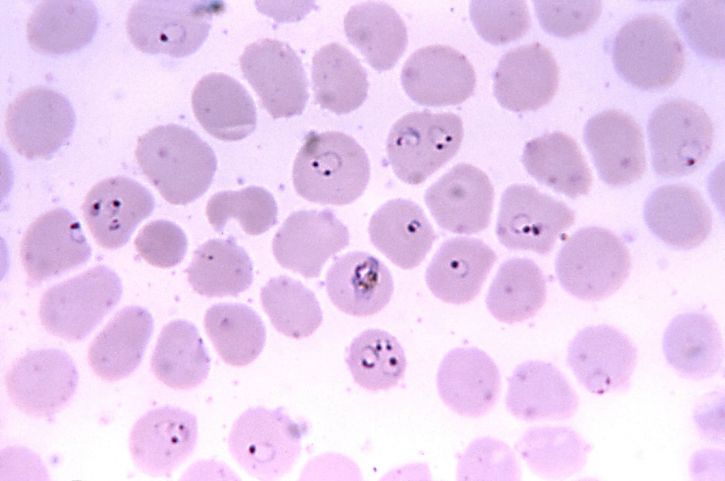 micrografía, Plasmodium falciparum, anillos, cada vez mayor, trophozoite, mag, 1125x