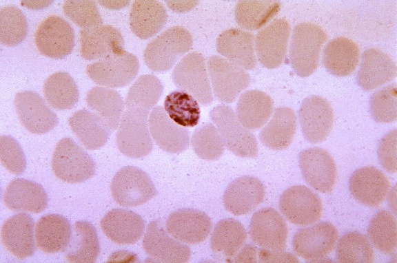不成熟, malariae 疟原虫, 裂殖体, 显示, 四, 细胞质, 染色质, 肿块