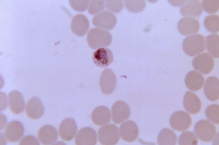 พัฒนา trophozoites, malariae โครมาติ น สามชั้น แวคิวโอลขนาดเล็ก พลาสซึม