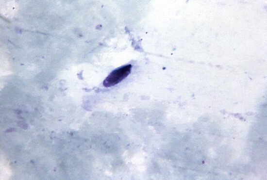 thick, film, micrograph, elongated, artifact, spore, closely, resembles, falciparum, gametocyte, mag, 1125x