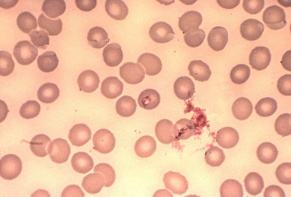 thin, film, slide, note, similarity, between, babesia, plasmodium parasite