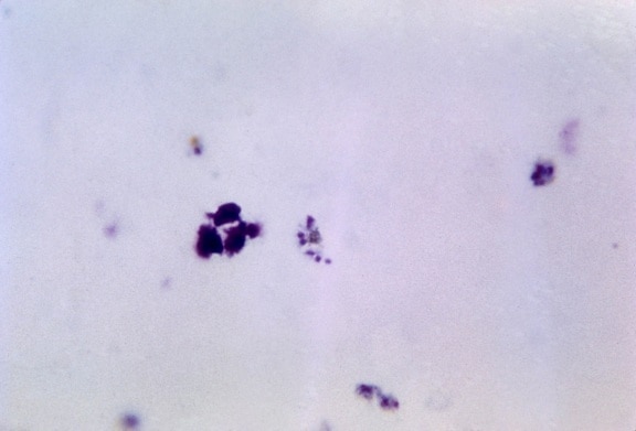 little, cytoplasm, visible, chromated, masses, merozoites