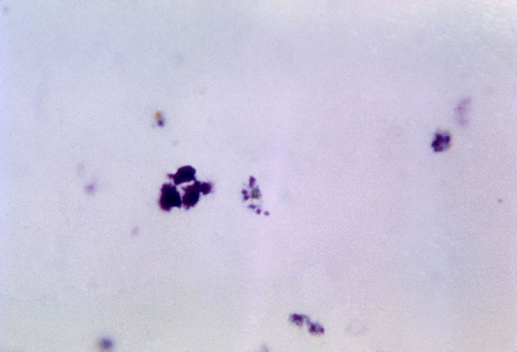 malý, cytoplazma, viditelné a pochromovaného, MAS, merozoites