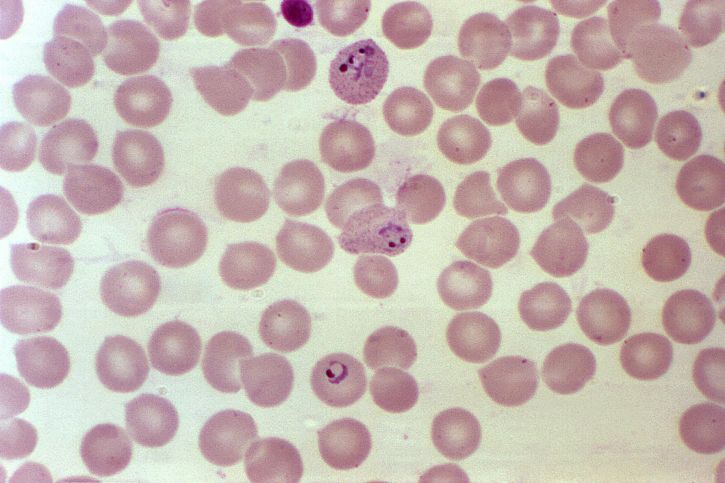 拡大すると、1000 の x、血液塗抹標本顕微鏡写真、赤血球、三日熱マラリア原虫、寄生虫を開発