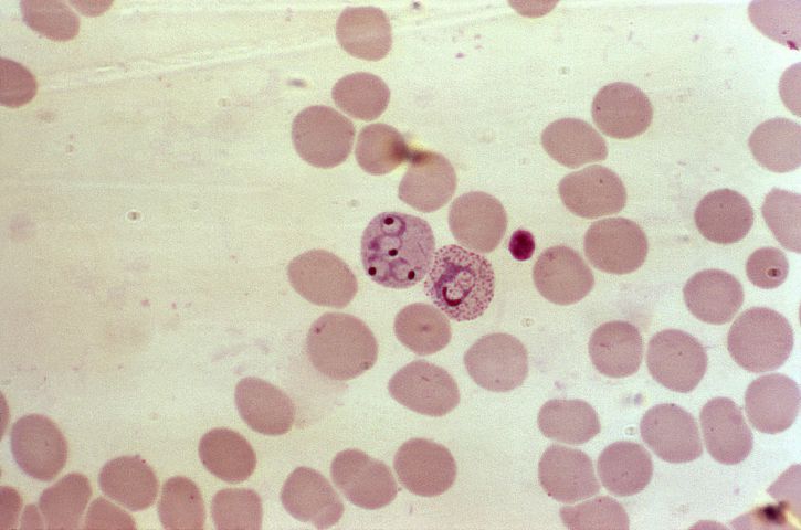 grossie, 1000x, microphotographie, rouge, sang, cellules, quatre, plasmodium vivax, anneaux, de plus en plus, trophozoïte