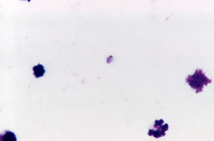 grossie, 1125x, microphotographie, présence, plasmodium malariae, immature, schizonte