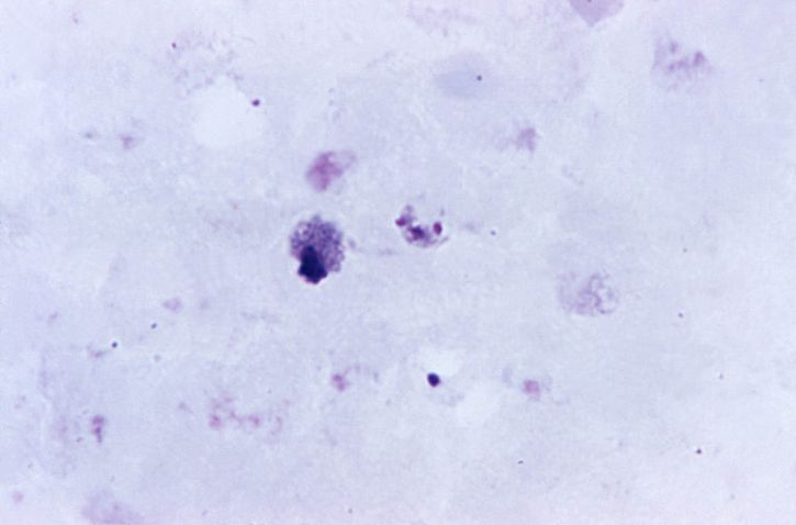 拡大、厚、膜 x 1125 アリキメデス、四日熱マラリア原虫、未熟な存在、シゾント