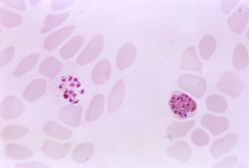 Free Picture Magnified X Thin Film Photomicrograph Blood Smear Presence Two