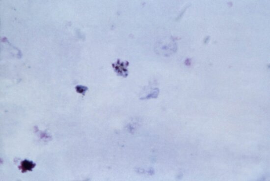 Free Picture: Micrograph, Immature, Plasmodium Vivax, Schizont