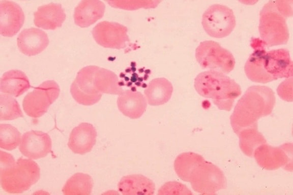 volwassen, plasmodium vivaxschizont, bloed-uitstrijkje