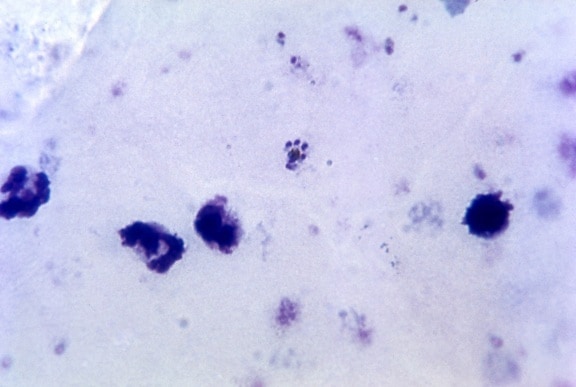 mature, schizonte, rosette, en forme, le cytoplasme, mérozoïtes, visible, agglutinées, pigment