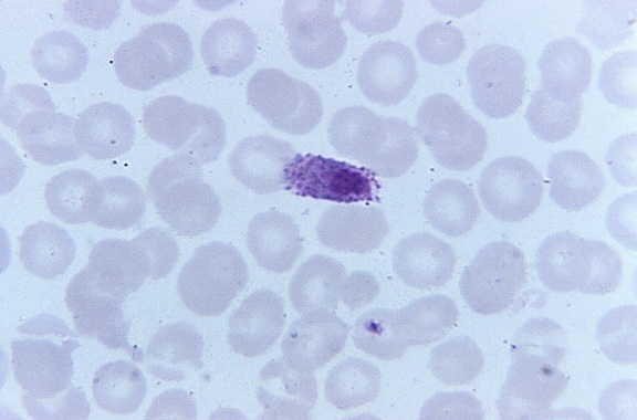 microgametocito, producto, eritrocítica, ciclo, se muestra, de forma ovalada