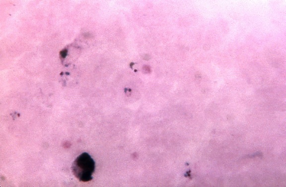 micrographie, contient, anneau, forme, trophozoïte, parasite, vivax, grossie, 1125x