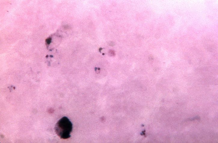 Mikrograf, innehåller, form, parasit, trophozoite, ring, vivax, förstorad, 1125 x