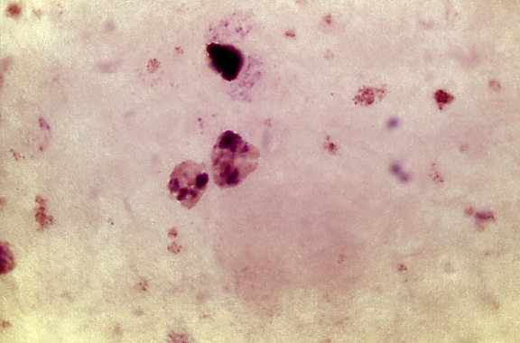 micrografía, contiene, ameboide, trophozoite, parásito, Plasmodium vivax, mancha