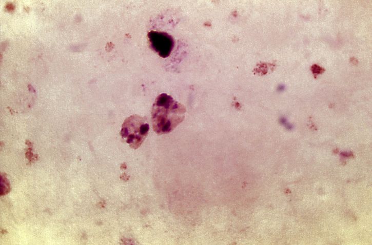 micrograph, contains, ameboid, trophozoite, parasite, plasmodium vivax, stain