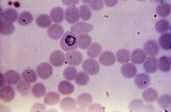 トロフォゾイト、三日熱マラリア原虫、コンパクト顕微鏡写真