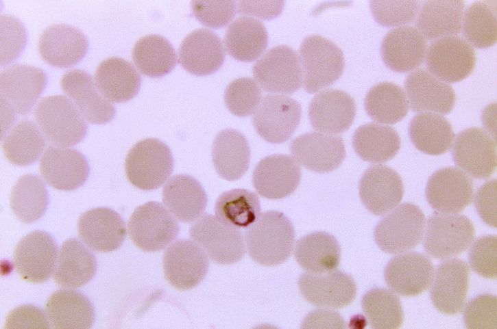 mikroskop-bilde, økende, plasmodium malariae, kurv, form, trophozoite