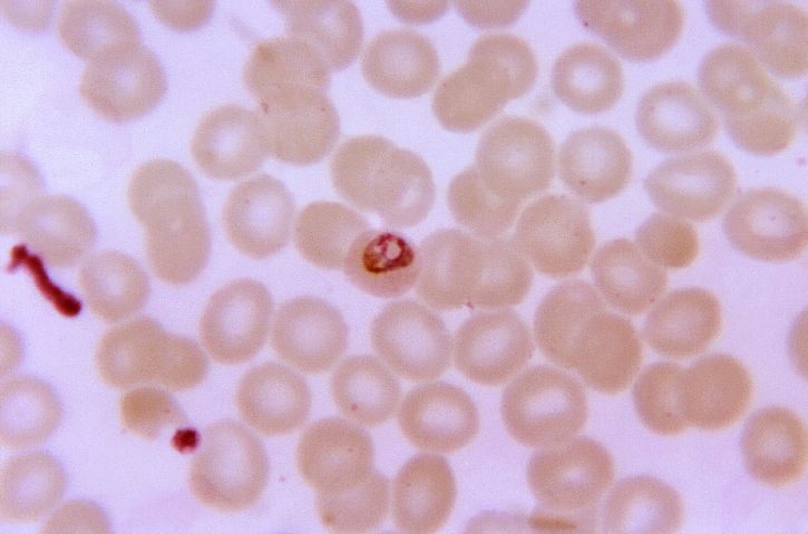 micrograph kasvaa, plasmodium malariae trophozoite