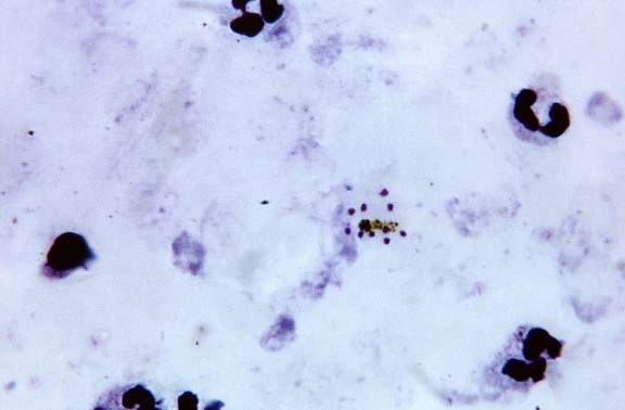 micrograph, mature, plasmodium malariae, schizont, ten, merozoites, scattered, faint, cytoplasm