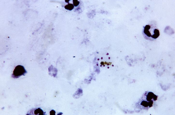 mikroskop-bilde, modne, plasmodium malariae, schizont, ti, merozoites, spredte, svak, cytoplasma