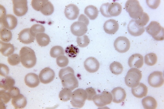 顕微鏡写真、成熟、四日熱マラリア原虫、シゾント、含む、9 メロゾイト