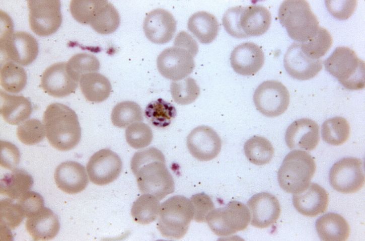 Micrografia, madura, plasmodium malariae, schizont, contém, nove, Merozoítas