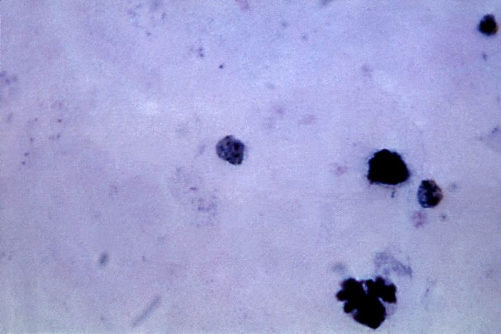 microfotografia, maturo, Plasmodium malariae, trofozoite, prominente, la pigmentazione