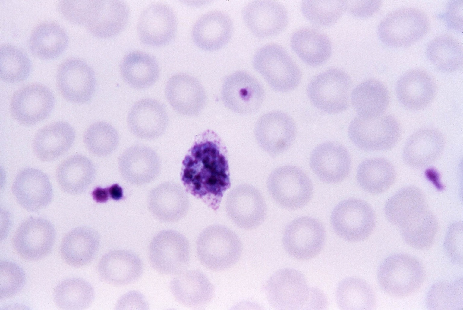 Free Picture Micrograph Mature Plasmodium Ovale Schizont