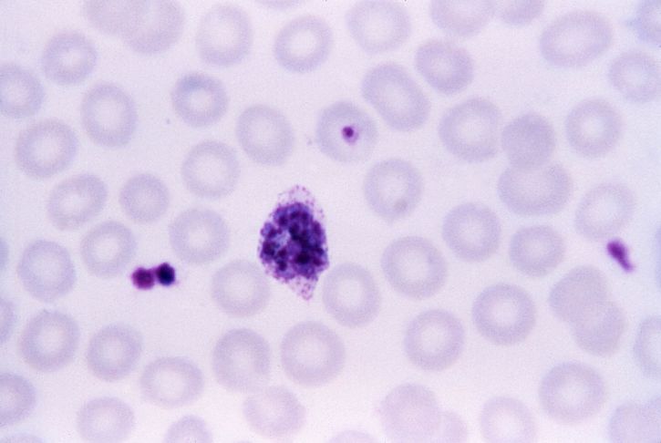 micrograph, mature, plasmodium ovale, schizont