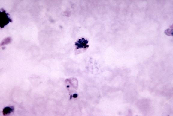 micrograph, mature, plasmodium vivax, schizont, growing, trophozoite