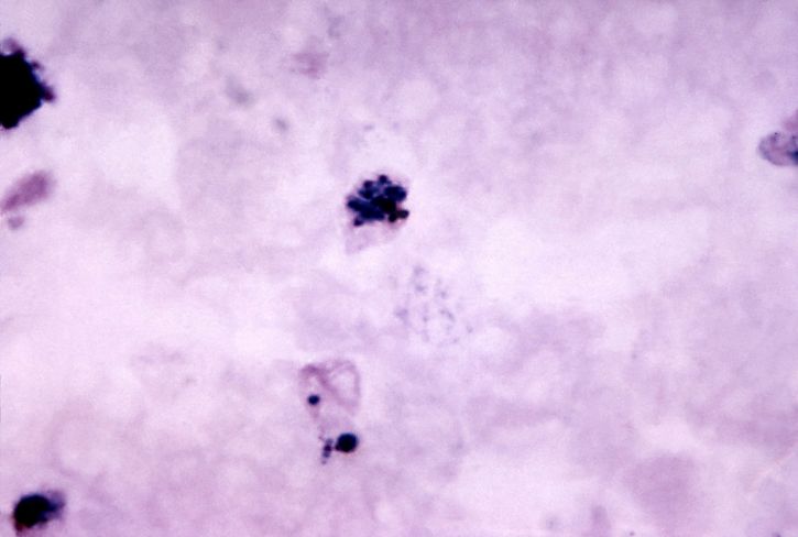 plasmodium vivax yang matang, mikrograf, dan schizont, tumbuh, trophozoite