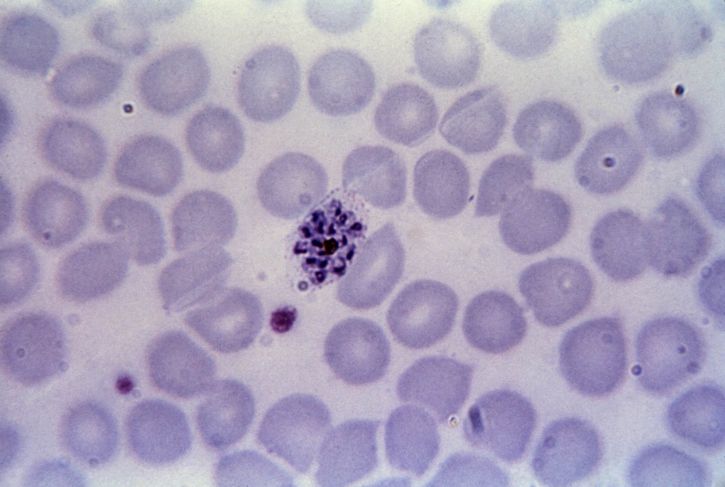 micrograph, mature, plasmodium vivax, schizont, merozoites