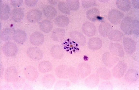 micrographie, matures, plasmodium vivax, schizonte, mérozoïtes, des cellules