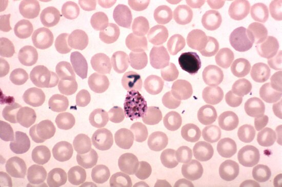 Kostenlose Bild Mikroskopische Aufnahme Plasmodium Malariae Microgametocyte