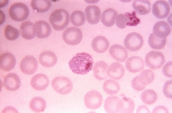 mikroskopische Aufnahme, Zellen, Blut, Plasmodium vivax, trophozoite