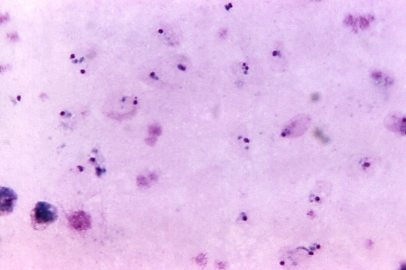 Микрофотография falciparum, gametocyte, malariae, растет, трофозоита, маг, 1125 x