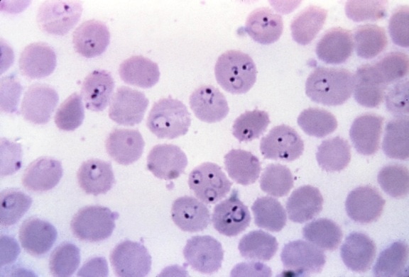 บอร์ดภาพ รูปแบบแหวน พลาสโมเดียม falciparum, trophozoites เซลล์ ติดเชื้อ