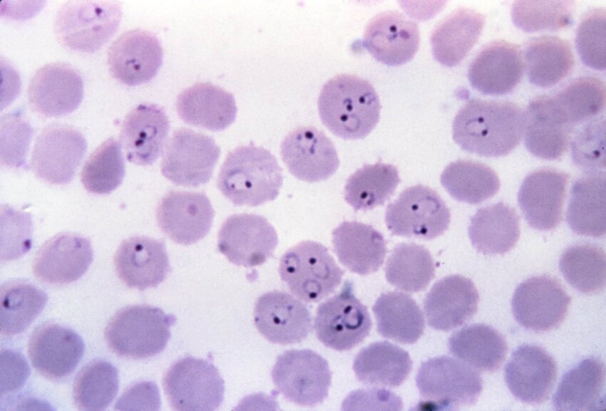 Free Picture Photo Micrograph Ring Form Plasmodium Falciparum Trophozoites Cells Infection