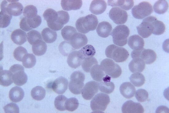 Imagem Gratuita Micrografia Madura Vivax Do Plasmodium Schizont Merozo Tas Mag X