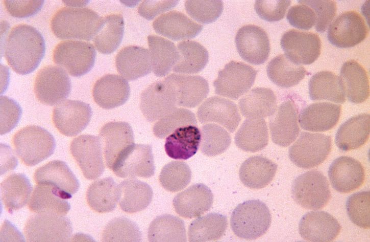 mikroskopa, plasmodium malariae, microgametocyte