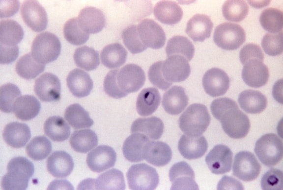 μικρογραφία, plasmodium malariae, δαχτυλίδι, μορφή, trophozoite