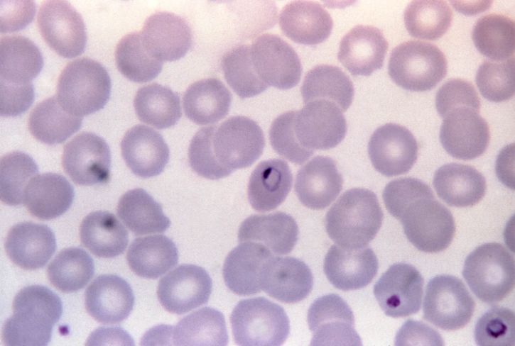 micrograph, plasmodium malariae, ring, hình thức, trophozoite