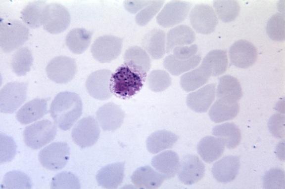 microfotografia, Plasmodium vivax, microgametocyte, ingrandita, 1125x