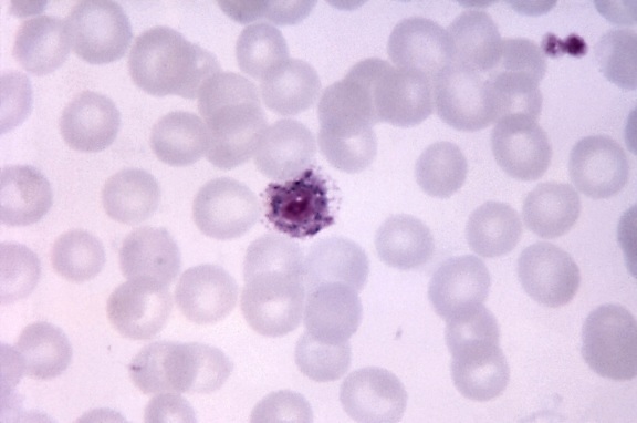 Micrografia, vivax do plasmodium, microgametocyte, azul, citoplasma, mag, 1125 x