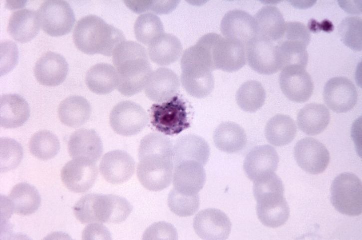 micrograph, plasmodium vivax, microgametocyte, màu xanh, tế bào chất, mag, 1125 x