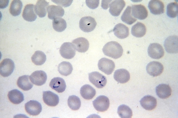 micrograph, plasmodium vivax, ring, form, growing, ameboid, trophozoite, mag, 1125x